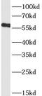 Cholinergic Receptor Nicotinic Alpha 7 Subunit antibody, FNab01680, FineTest, Western Blot image 