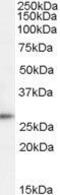 Tumor Protein D52 antibody, GTX88974, GeneTex, Western Blot image 