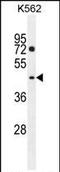 Peptidase M20 Domain Containing 2 antibody, PA5-35048, Invitrogen Antibodies, Western Blot image 