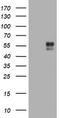 B And T Lymphocyte Associated antibody, LS-C797638, Lifespan Biosciences, Western Blot image 