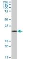 Nicotinamide mononucleotide adenylyltransferase 1 antibody, H00064802-B01P, Novus Biologicals, Western Blot image 