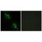 Creatine Kinase, Mitochondrial 2 antibody, PA5-49789, Invitrogen Antibodies, Immunofluorescence image 