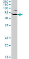 Ezrin antibody, LS-C133973, Lifespan Biosciences, Western Blot image 