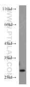 RAB23, Member RAS Oncogene Family antibody, 11101-1-AP, Proteintech Group, Western Blot image 