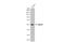 SMAD Family Member 9 antibody, GTX114540, GeneTex, Western Blot image 