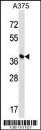 Diphthamide biosynthesis protein 1 antibody, 58-570, ProSci, Western Blot image 