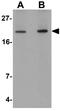 Anaphase Promoting Complex Subunit 10 antibody, GTX17067, GeneTex, Western Blot image 