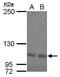 OCRL Inositol Polyphosphate-5-Phosphatase antibody, PA5-27844, Invitrogen Antibodies, Western Blot image 