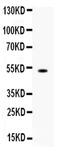 Fc Fragment Of IgG Receptor And Transporter antibody, PA5-79246, Invitrogen Antibodies, Western Blot image 