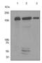 MutS Homolog 6 antibody, ab92471, Abcam, Western Blot image 