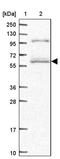 SMG9 Nonsense Mediated MRNA Decay Factor antibody, PA5-59714, Invitrogen Antibodies, Western Blot image 