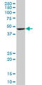 Bleomycin Hydrolase antibody, LS-C196754, Lifespan Biosciences, Western Blot image 