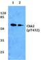 Checkpoint Kinase 2 antibody, PA5-37339, Invitrogen Antibodies, Western Blot image 