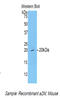 Alpha-2-macroglobulin antibody, LS-C299862, Lifespan Biosciences, Western Blot image 