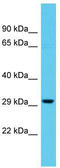 Tubulin Tyrosine Ligase Like 11 antibody, TA331535, Origene, Western Blot image 