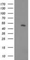 Phosphatidylinositol-5-Phosphate 4-Kinase Type 2 Alpha antibody, NBP2-03492, Novus Biologicals, Western Blot image 