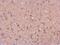 Heat Shock Protein 90 Alpha Family Class B Member 1 antibody, PA5-27410, Invitrogen Antibodies, Immunohistochemistry frozen image 