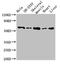 Asparagine Synthetase (Glutamine-Hydrolyzing) antibody, LS-C677209, Lifespan Biosciences, Western Blot image 