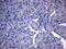 DHSB antibody, LS-C791480, Lifespan Biosciences, Immunohistochemistry paraffin image 