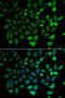 mCAC antibody, STJ28960, St John