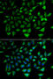 Solute Carrier Family 25 Member 20 antibody, STJ28960, St John