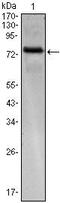 Kelch Like Family Member 25 antibody, MA5-15656, Invitrogen Antibodies, Western Blot image 