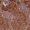 Ras association domain-containing protein 2 antibody, PA5-62344, Invitrogen Antibodies, Immunohistochemistry paraffin image 