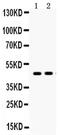 AT-1 antibody, PA5-78742, Invitrogen Antibodies, Western Blot image 