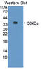 Glutamine-Fructose-6-Phosphate Transaminase 2 antibody, abx128195, Abbexa, Western Blot image 