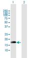 Zinc Finger Protein 576 antibody, H00079177-B01P, Novus Biologicals, Western Blot image 