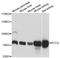 Propionyl-CoA Carboxylase Subunit Alpha antibody, A9486, ABclonal Technology, Western Blot image 