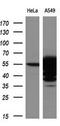 Aldehyde Dehydrogenase 3 Family Member A1 antibody, GTX84889, GeneTex, Western Blot image 