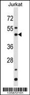 BCL2 Associated Athanogene 5 antibody, 58-481, ProSci, Western Blot image 