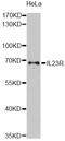 Interleukin 23 Receptor antibody, STJ24181, St John