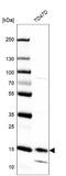 Prolactin Induced Protein antibody, NBP1-83386, Novus Biologicals, Western Blot image 