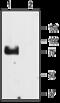 Sodium Channel Epithelial 1 Gamma Subunit antibody, GTX54801, GeneTex, Western Blot image 