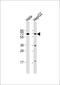 Zinc Finger And BTB Domain Containing 7B antibody, A06831, Boster Biological Technology, Western Blot image 