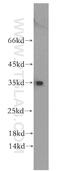 Regulator Of Calcineurin 2 antibody, 12900-1-AP, Proteintech Group, Western Blot image 