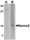 Ribosomal Protein S6 Kinase A5 antibody, orb6444, Biorbyt, Western Blot image 