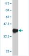 Transcription Factor AP-2 Gamma antibody, H00007022-M01, Novus Biologicals, Western Blot image 