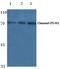 Inter-Alpha-Trypsin Inhibitor Heavy Chain 1 antibody, PA5-37430, Invitrogen Antibodies, Western Blot image 