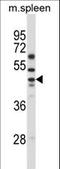 Solute Carrier Family 30 Member 6 antibody, LS-C161215, Lifespan Biosciences, Western Blot image 