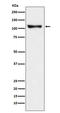 Discs Large MAGUK Scaffold Protein 2 antibody, M04826, Boster Biological Technology, Western Blot image 