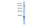 DEAH-Box Helicase 37 antibody, PA5-41296, Invitrogen Antibodies, Western Blot image 