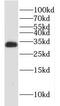 Heterogeneous Nuclear Ribonucleoprotein C (C1/C2) antibody, FNab03949, FineTest, Western Blot image 