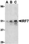 Activating Transcription Factor 2 antibody, orb5729, Biorbyt, Western Blot image 