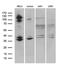 SGT1 Homolog, MIS12 Kinetochore Complex Assembly Cochaperone antibody, LS-C795269, Lifespan Biosciences, Western Blot image 