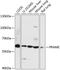 Preferentially Expressed Antigen In Melanoma antibody, GTX66261, GeneTex, Western Blot image 