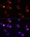Arrestin Beta 1 antibody, LS-C746720, Lifespan Biosciences, Immunofluorescence image 