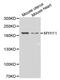 Myosin Heavy Chain 11 antibody, MBS126869, MyBioSource, Western Blot image 